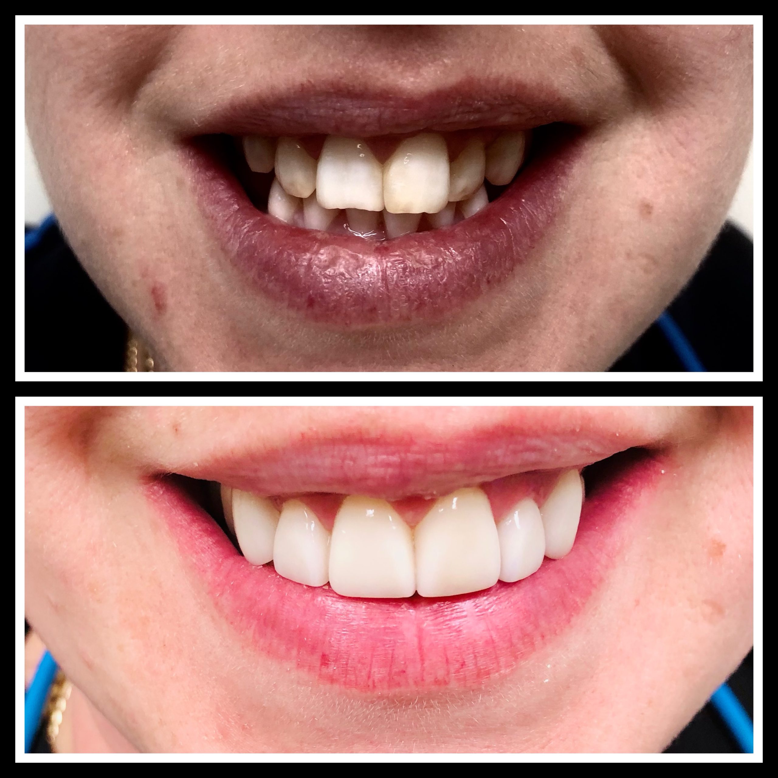 Before and after photo