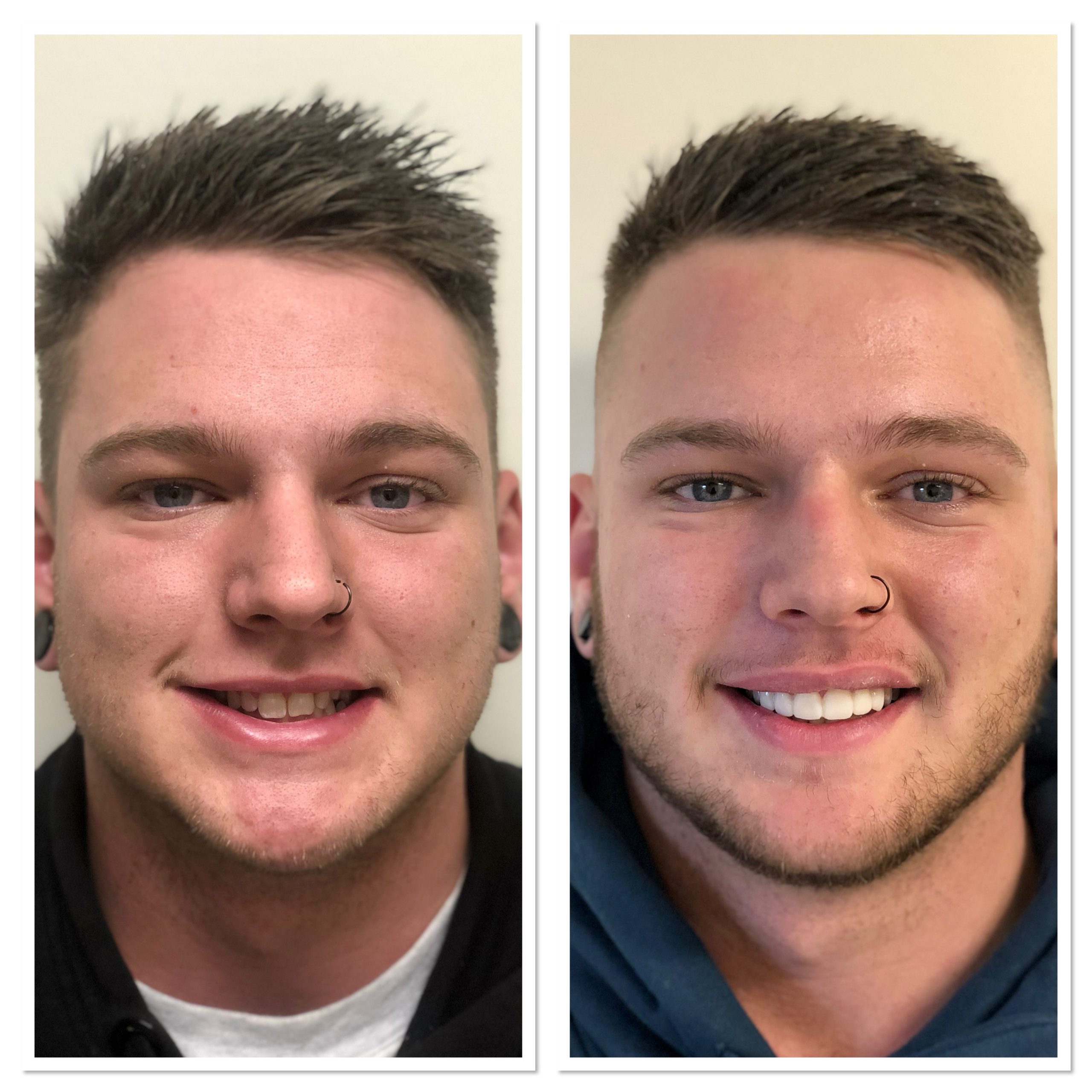 Before and after photo