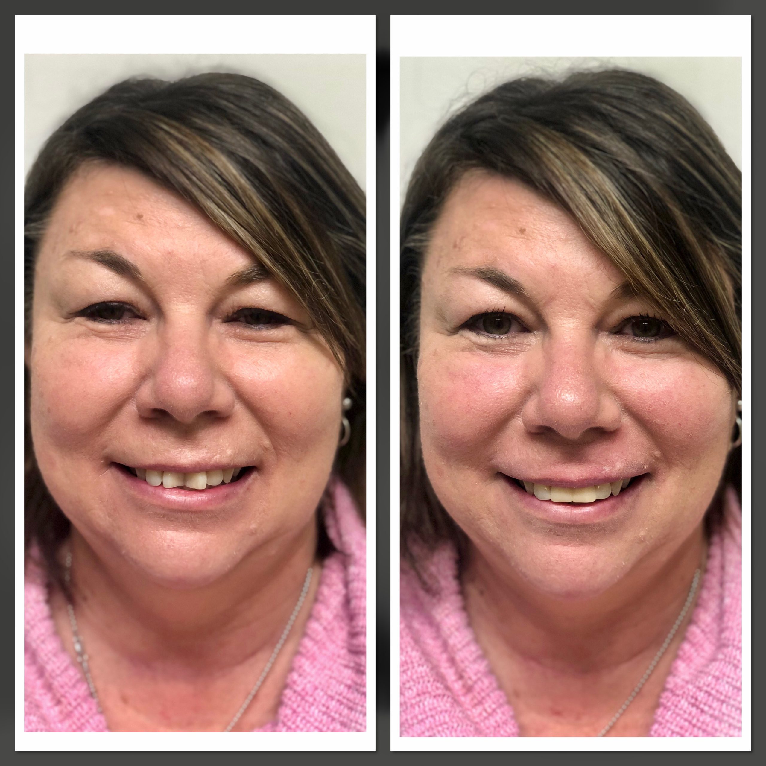 Before and after photo