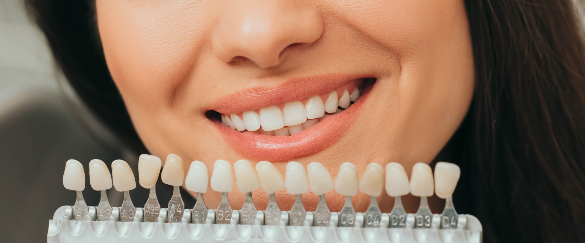 Woman holding a teeth palette with different shades of teeth