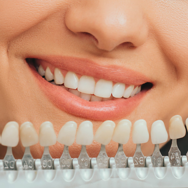 Woman holding a teeth palette with different shades of teeth